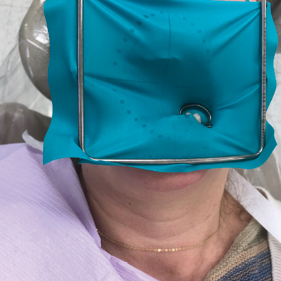 A case for the rubber dam: How the dental dam improves treatment and patient quality of care