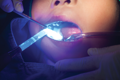 Ask the Experts: Our go-to sealants for pediatric and adult patients